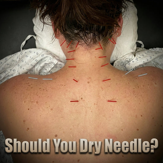 Should you dry needle?