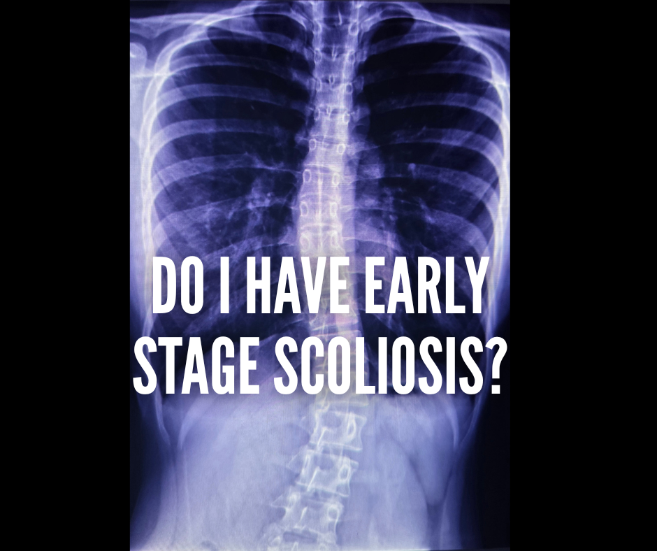 Do I Have Early Stage Scoliosis?